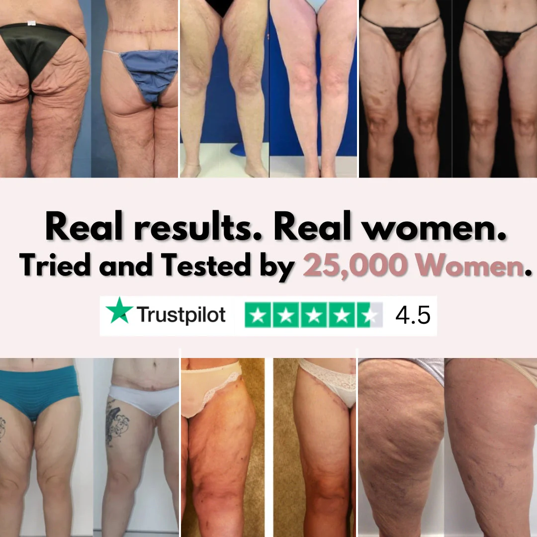 Firmer, smoother legs in 14 days — for women tired of saggy skin holding them back - Image 6
